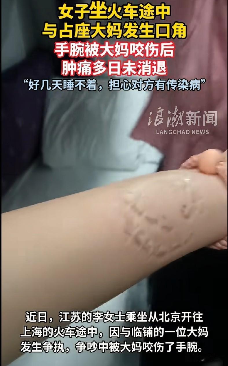 真是大千世界，无奇不有。谁能料到，坐个火车竟会被人咬伤！近日，江苏的李女士在乘