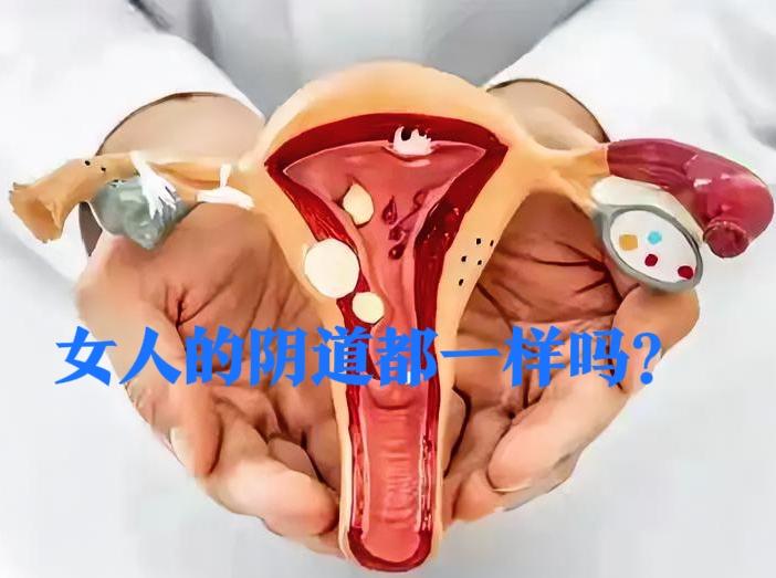 女人的阴道是不是都一模一样的？女性生殖道妇科阴道彩超说实话，我以前也以为