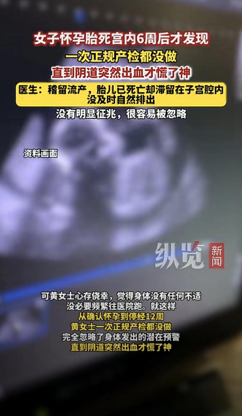 5月4日新闻回头看报道，广东汕头。黄女士捂着肚子冲进急诊室，怀孕12周，下体出血