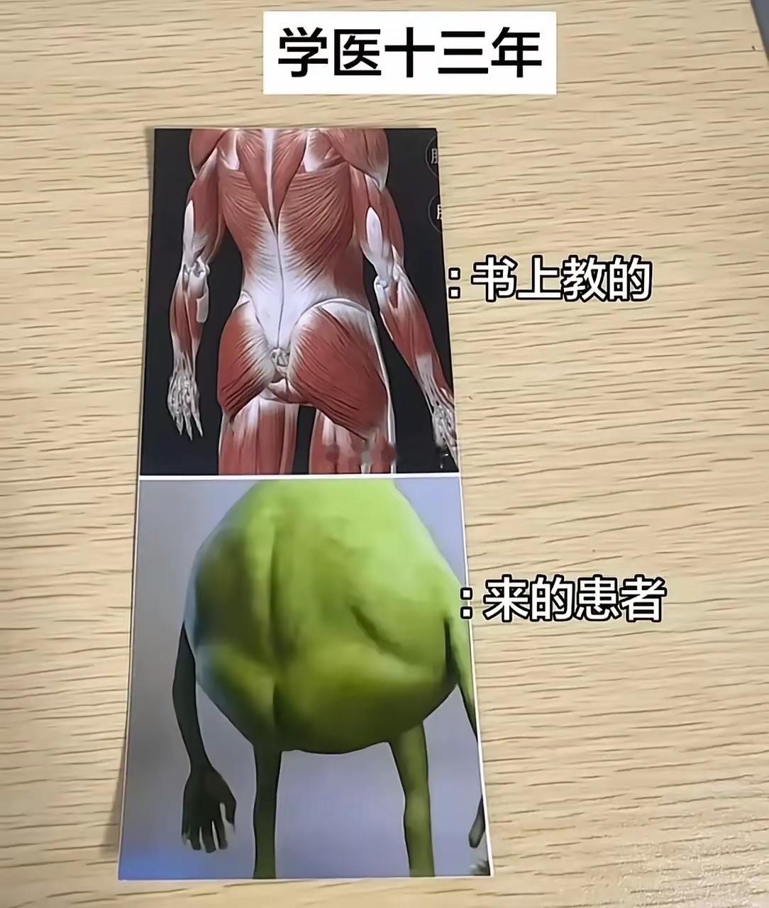 就像我去按摩，大姐说，很少有身材标准的人来，要不就是筋骨特别硬的，要不就是像我这
