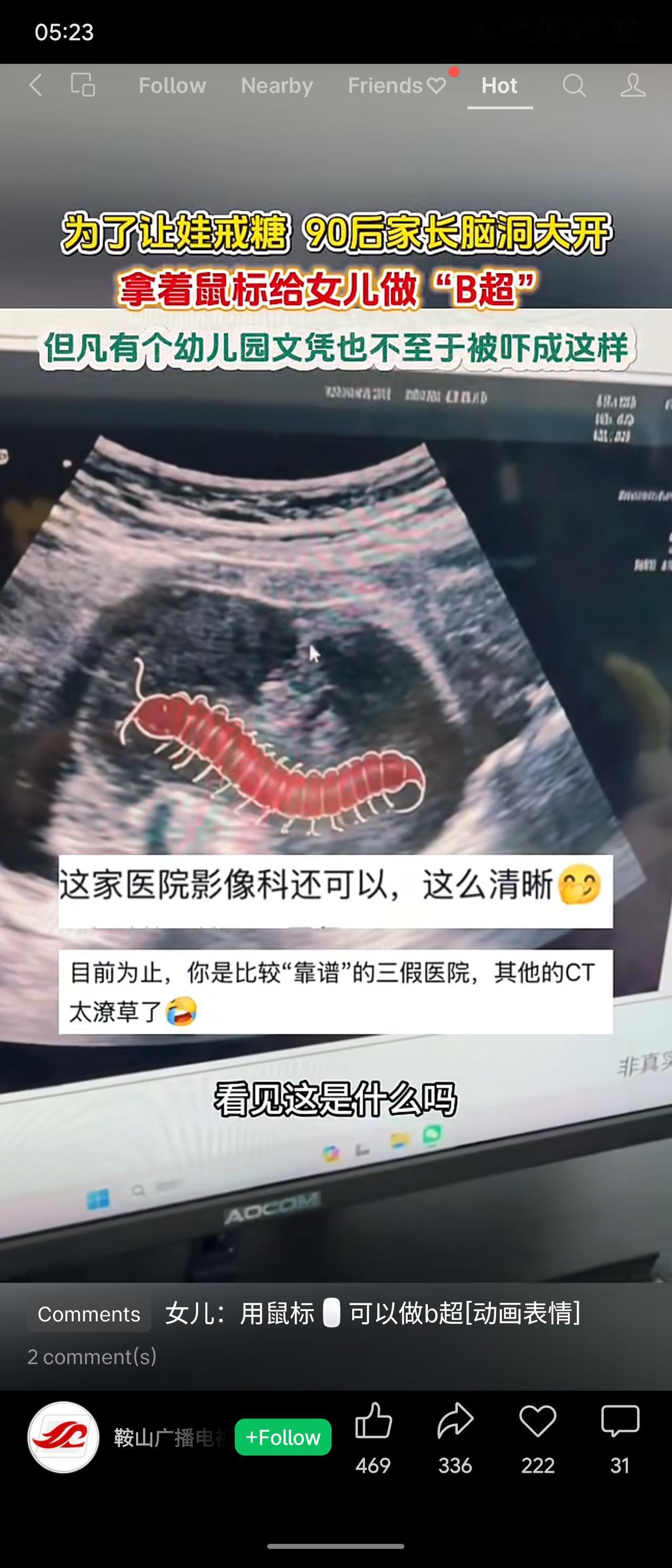 90后家长为让女儿戒糖，拿鼠标当“B超探头”假装检查，并展示虚构影像，孩子被吓到