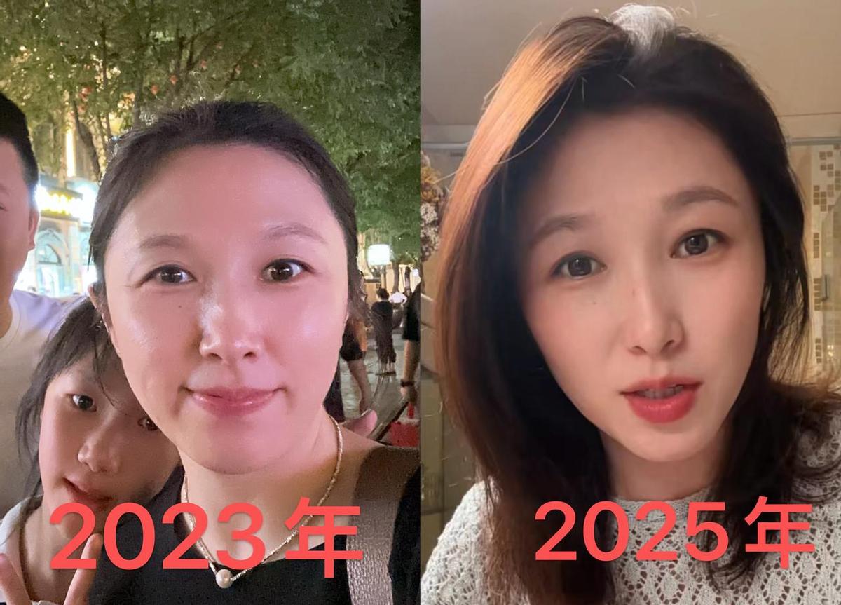 半年前她还在抱怨皮肤松、头发掉、怎么吃都不瘦。半年后，朋友问她是不是偷偷做了医