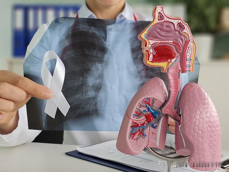 术后十年生存率约八成；纯磨玻璃约95%、十年无复发。记住“五年期”：复发多在5年