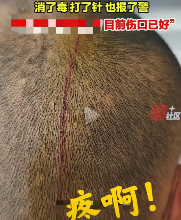 报警有用吗？报警抓谁？5月6号，江苏苏州，一光头男子正在大街上准备吸烟，烟还没