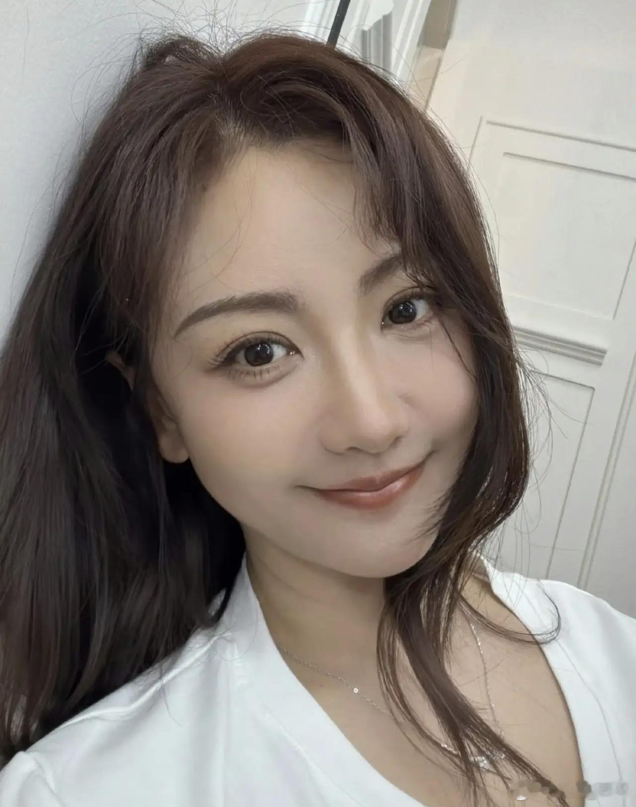 杨蓉面部烫伤恢复近照杨蓉面部烫伤恢复近照太飒了！带疤的脸很酷，姐姐的通透才是真美