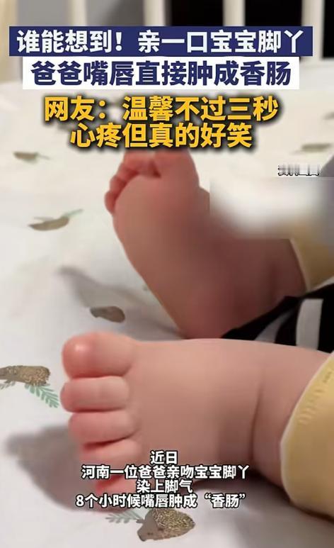 太意外！河南一宝爸抱着宝宝的小脚丫亲了几口，没想到8小时后嘴唇又痒又肿，直接变成