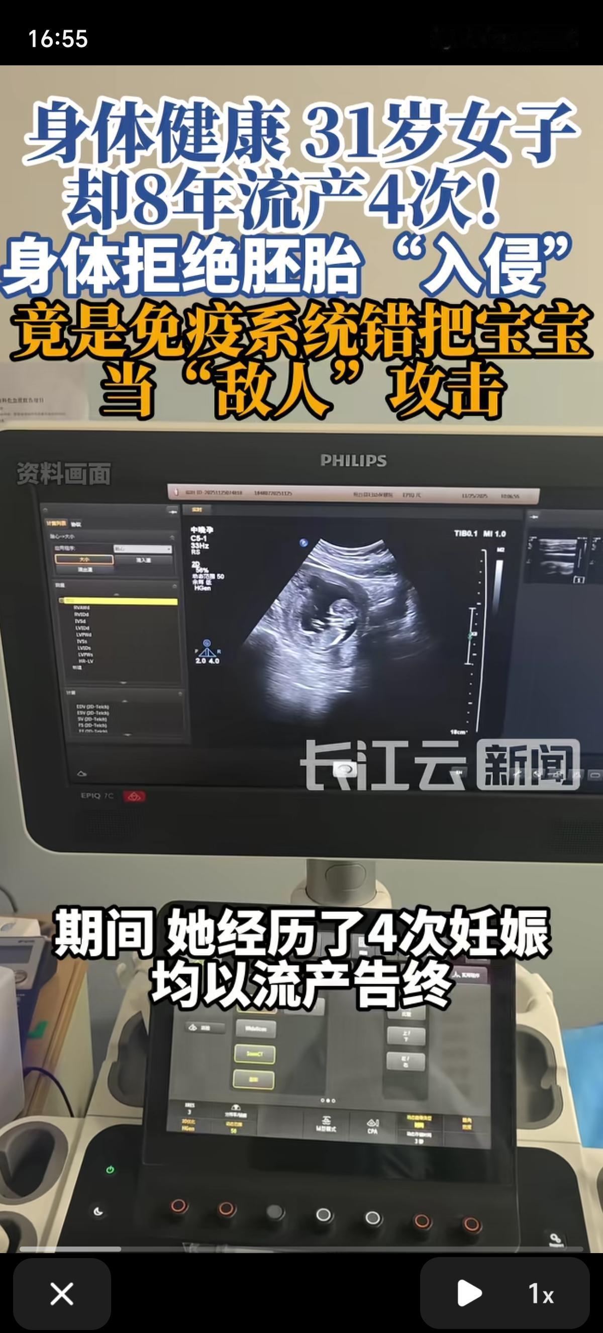 31岁女子8年里4次妊娠以流产告终，身体健康状况良好，竟然是免疫系统错把宝宝当成
