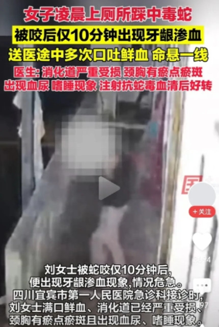 毒性太强了！云南昭通，女子凌晨上厕所，不小心踩到毒蛇，家人立即送医，不料，被咬
