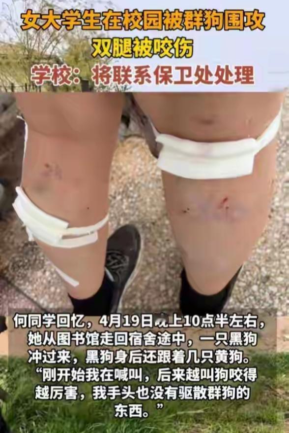 平顶山学院又冲上热搜，去年因为保安打流浪狗冲上热搜，今年因为流浪狗咬伤女大学生又
