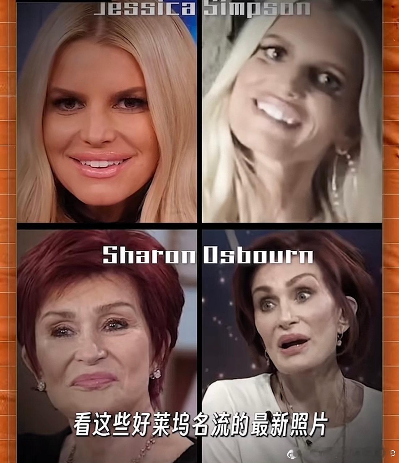 兄弟姐妹们！这个世界上真的有走捷径能让你减肥身材苗条的“网红减肥针”吗...