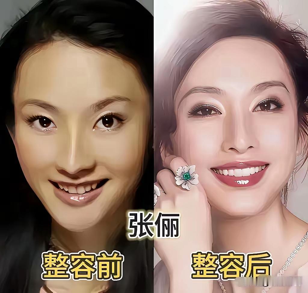 明星们的底子果然是好，你看这些明星虽然也都整容了，但是正是因为人家的基础好，所以
