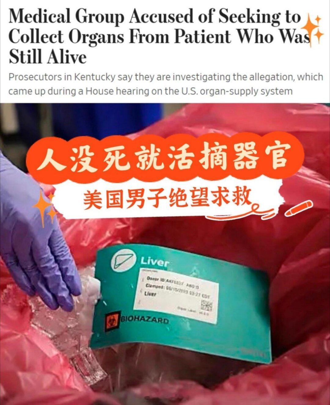 美国被爆发生多起供体未死亡被摘器官！美媒纽约时报揭露医生在患者没死时急着摘器官，