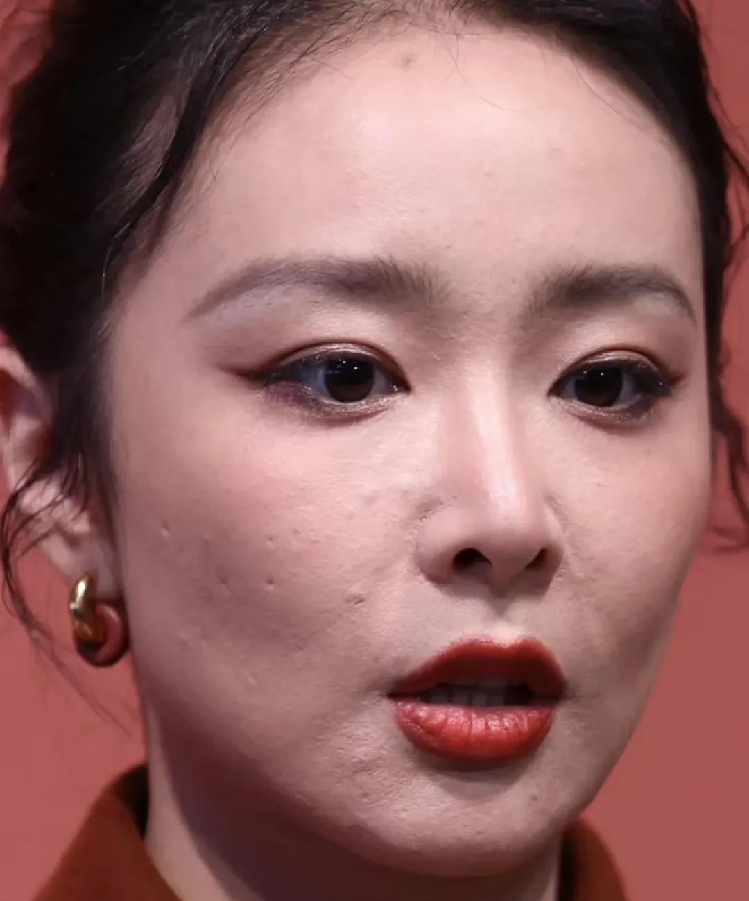 高叶这脸太真实了！双眼皮自然，皮肤状态一看就是真人——有痘痘、痘坑，油皮瑕疵都看
