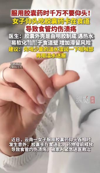 云南，一女子生病去医院，医生给开了一些胶囊药，可女子却咽不下去，每次都要仰头吃药