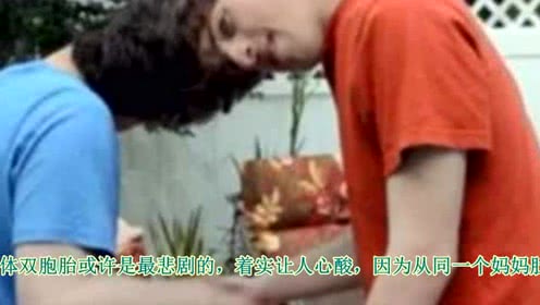 贫穷孩子没东西吃 4790333070172846207.jpg?id=0