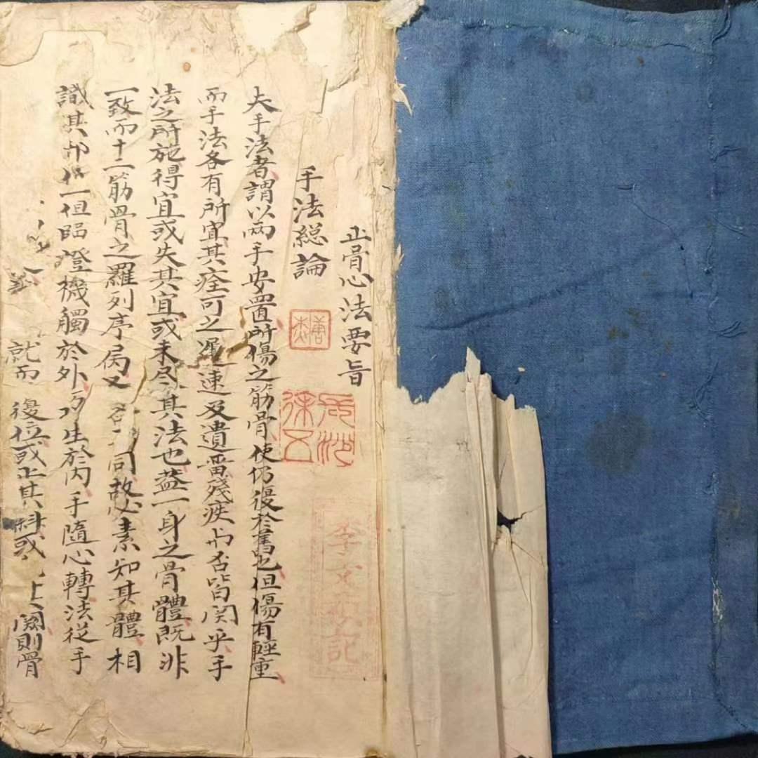 【正骨心法要旨】清代名师秘传各种正骨接骨手法身体各种骨折绑法