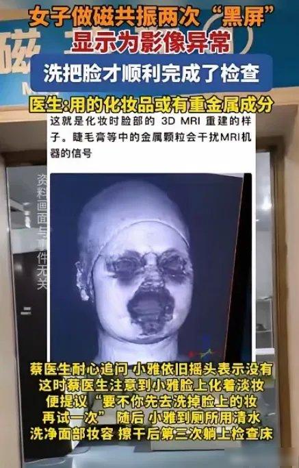 解释不清了！福州29岁的小林上周老觉得头晕，就去市三院挂了专家号做脑部核磁，躺进