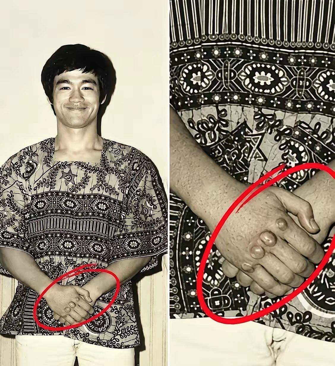 李小龙的手令人印象深刻，是长期高强度武道训练留下的痕迹。当年的他坚持苦修，手上关