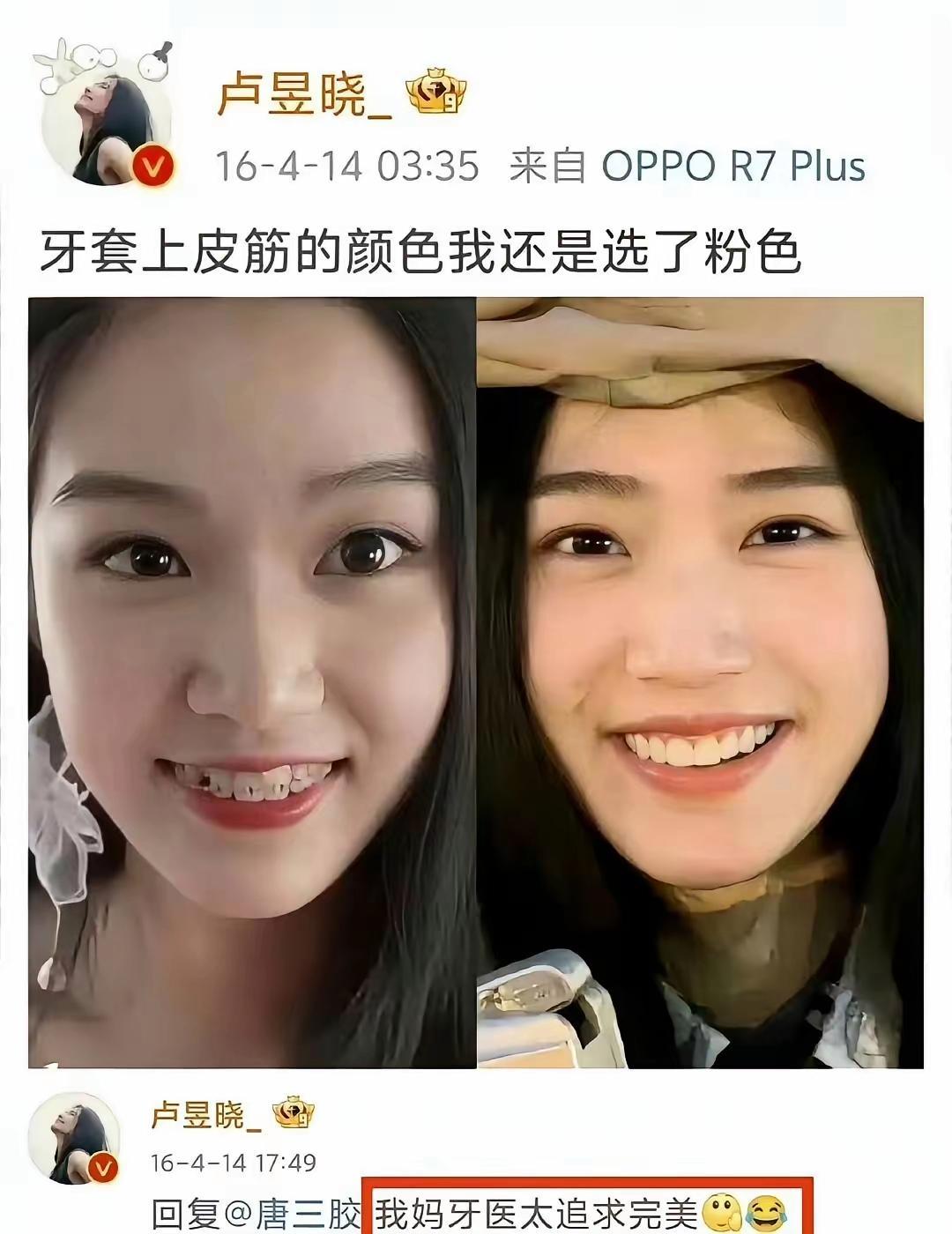看了卢昱晓的牙套，我才明白江浙沪独生女的含金量