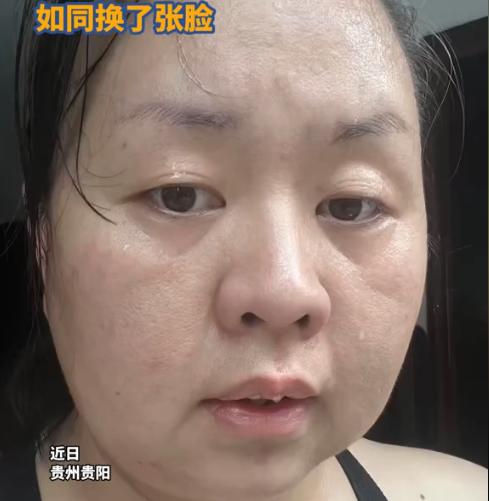 “太厉害了！”2024年，贵州贵阳，41岁宝妈平常喜欢喝奶茶饮料，体重最重时达到