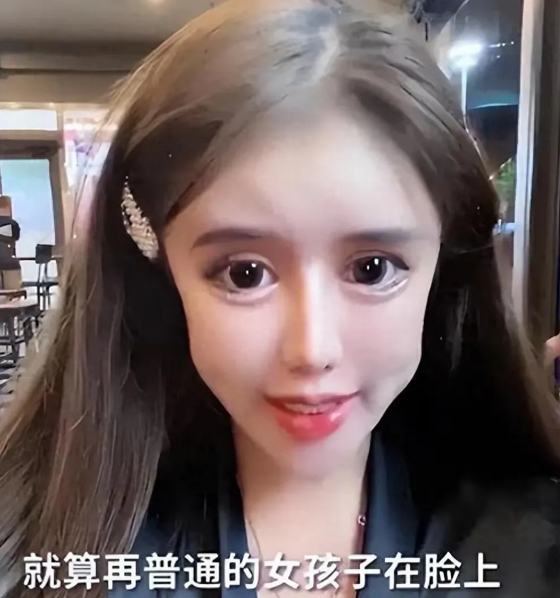 上海整容狂人周楚娜，2年砸400万削骨头，又是往脸上疯狂填东西，结果呢？整