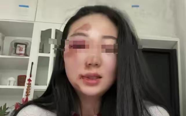 女婿昨天把女儿打了，我气的问啥原因，为什么敢打我的宝贝女儿，女婿说，女儿每天下班