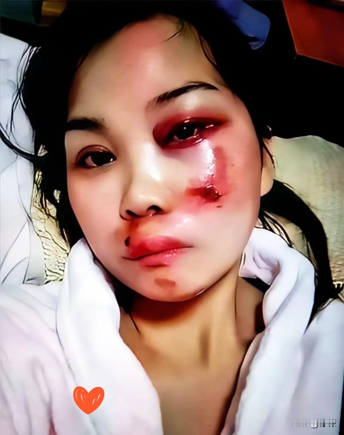 湖北襄阳的刘女士，这是要搬起石头砸自己的脚吗？她公开发布了一个被家暴的视频，