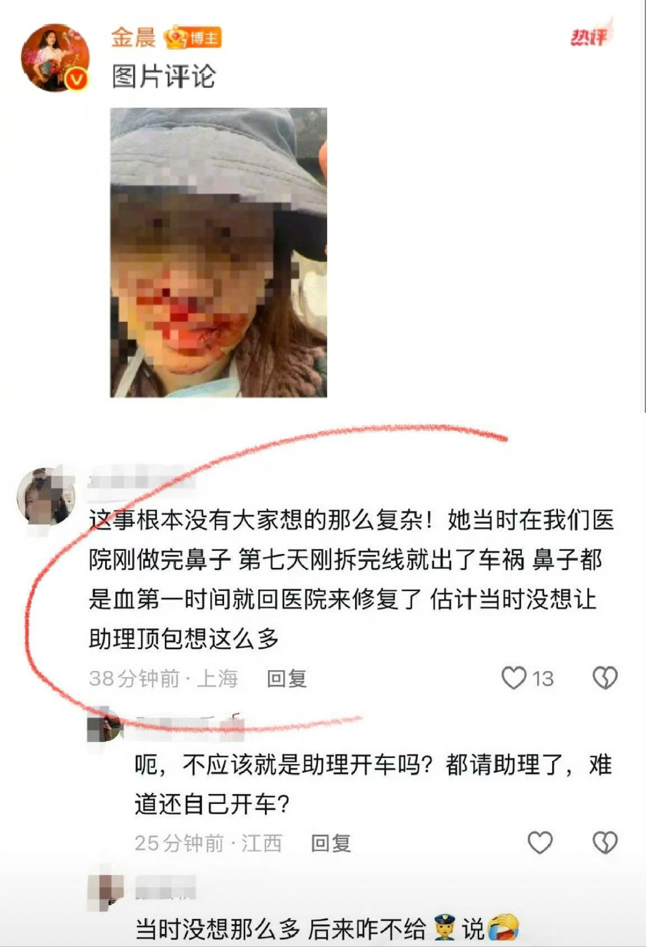 警方通报只是简单说明了事故经过，但疑点颇多，助理“顶包”行为是自作主张，还是金晨