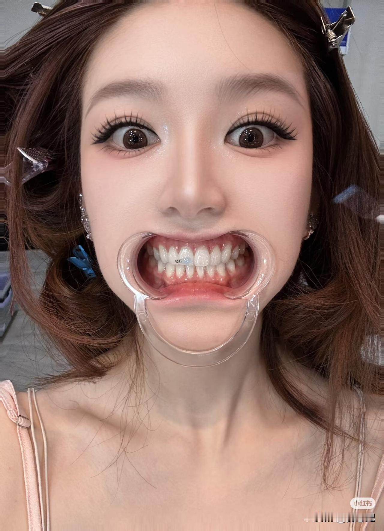 赵露思的牙齿一看就是又健康又完美