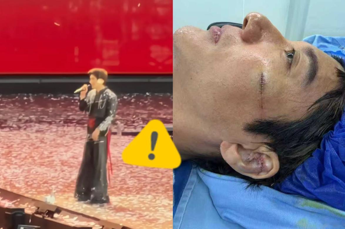 王力宏这一摔，反而因祸得福了？说实话，换别人可能真就凉了。舞台事故、受伤停工、