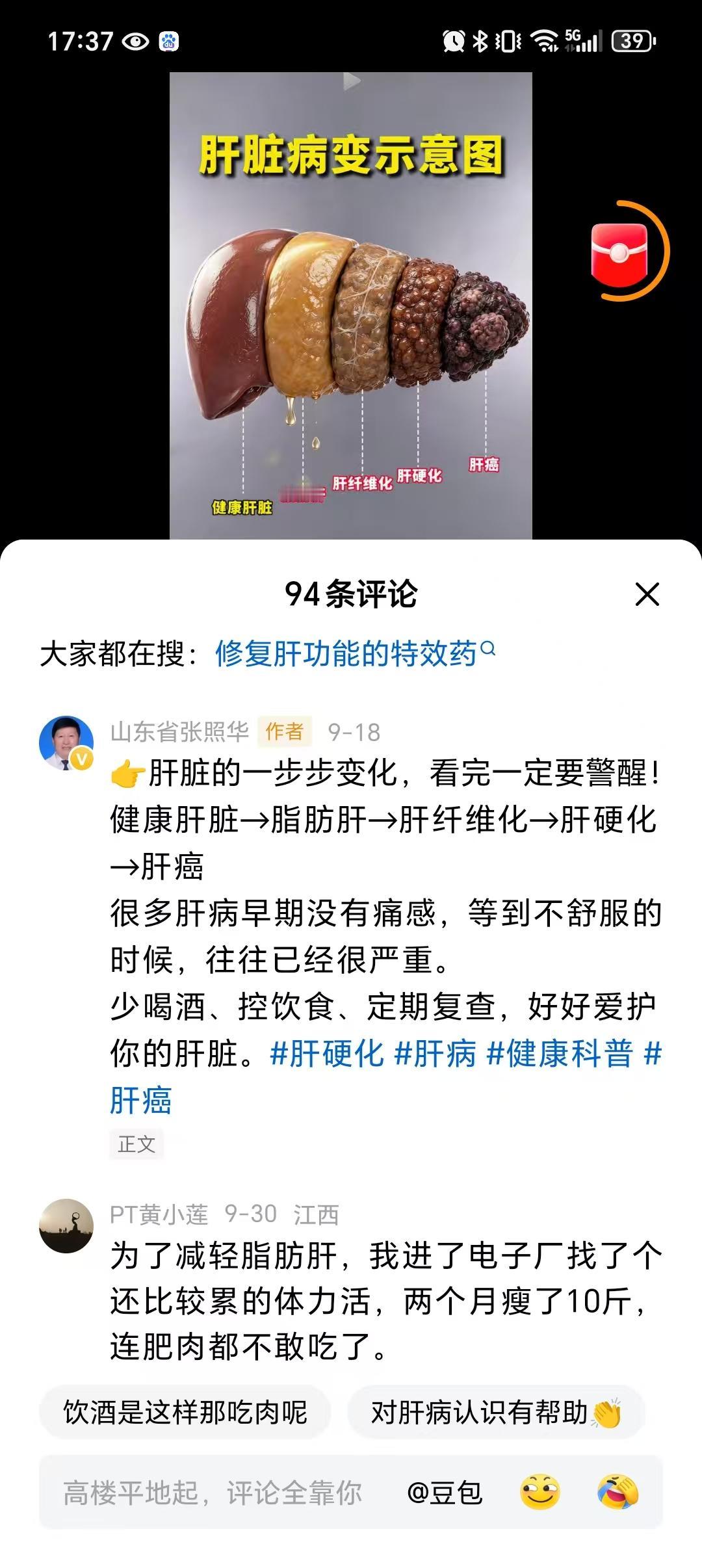 别等肝疼了才后悔！这个“肝脏病变示意图”，看完一身冷汗今天刷到一个视频，视频中