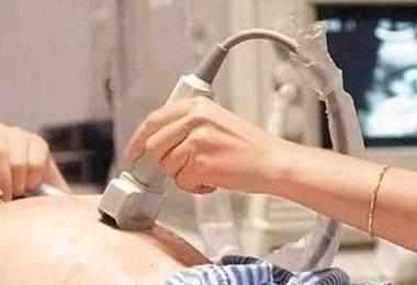 怀孕两年, 宝宝不肯出来, 老公决心离婚