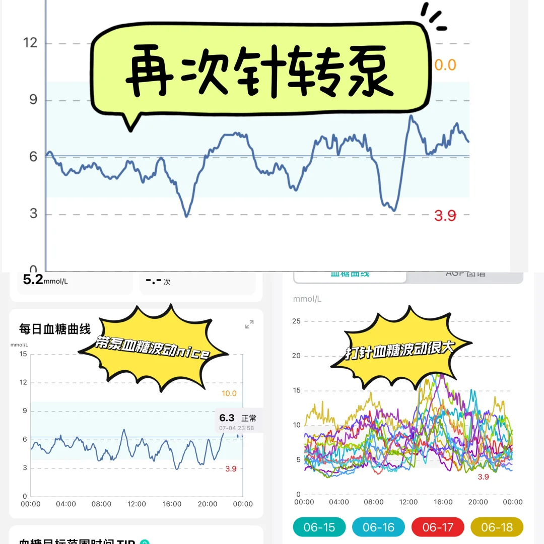 打针与带泵哪种控糖方式更好
