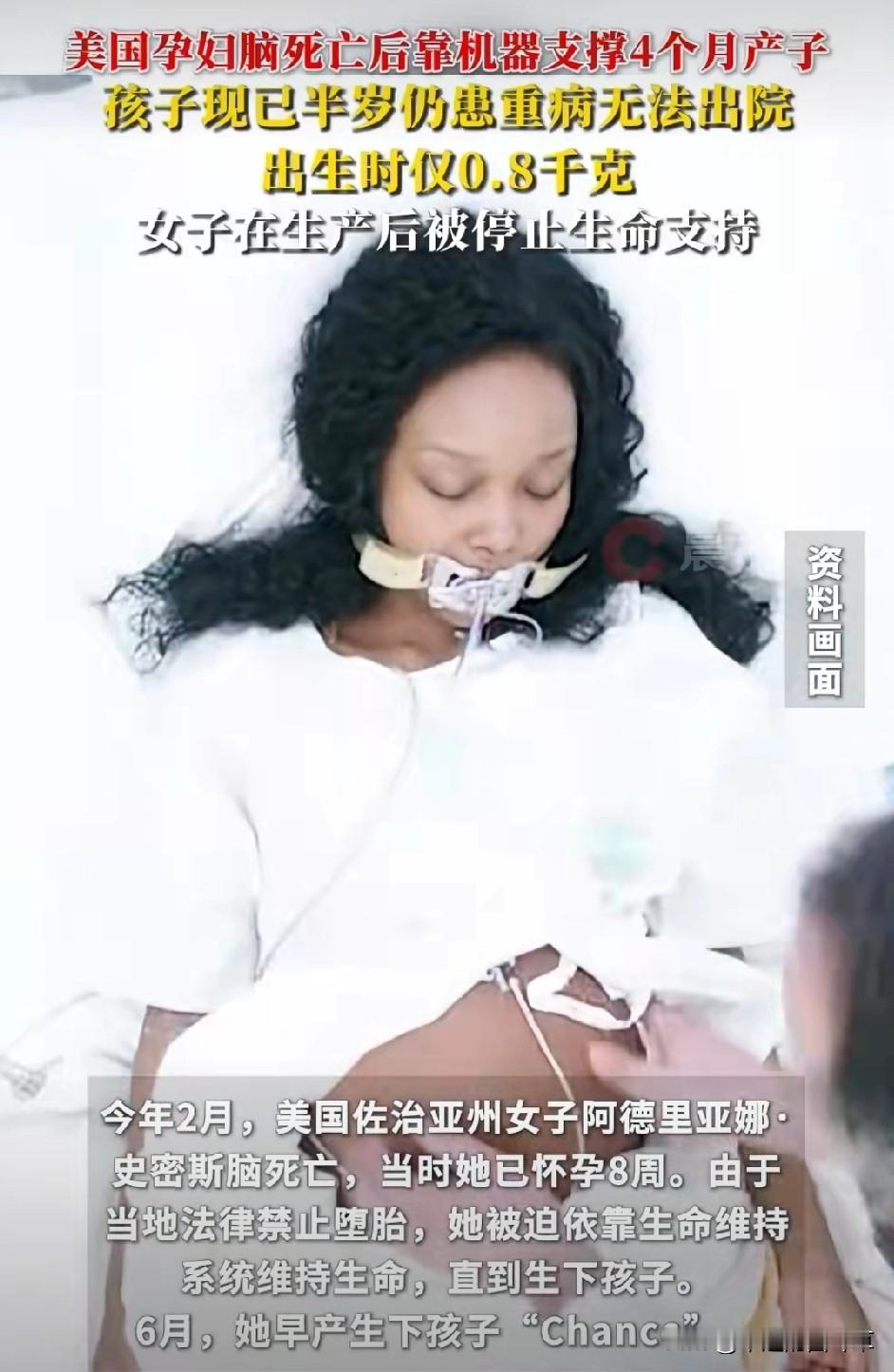 真开眼了！这事儿荒唐到让人不敢信！今年2月，一名美国佐治亚州的女子突然脑死亡，那