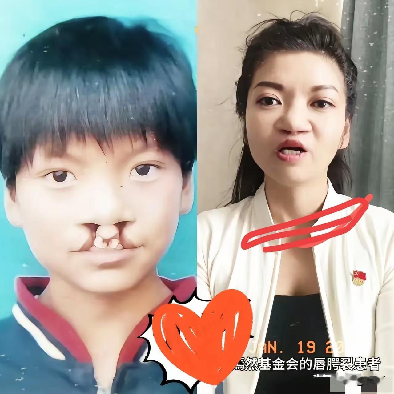 4天收入1600万网友这钱不是给的李亚鹏也不是给的嫣然医院，而是给了在嫣然