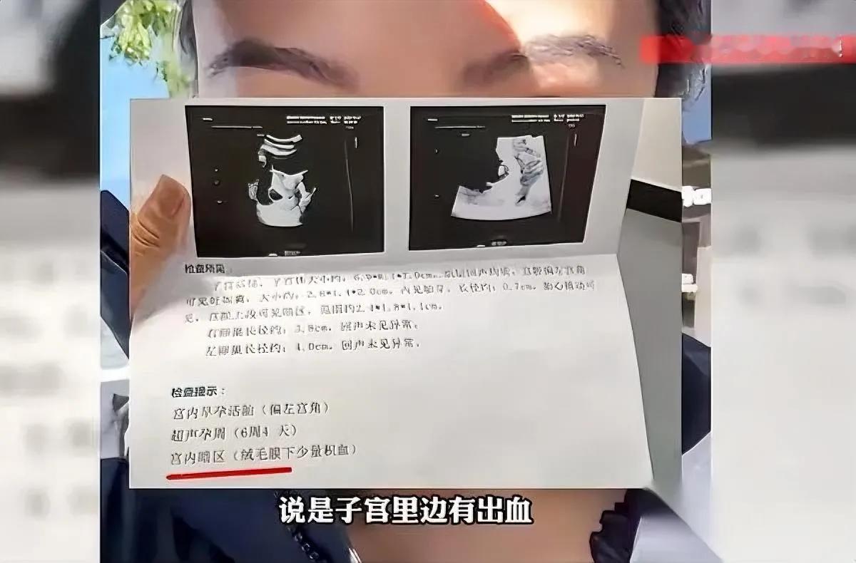 孕期用电热毯险失胎儿！北京一孕妈腹痛就医，医生竟说再用两天就晚了！原来电