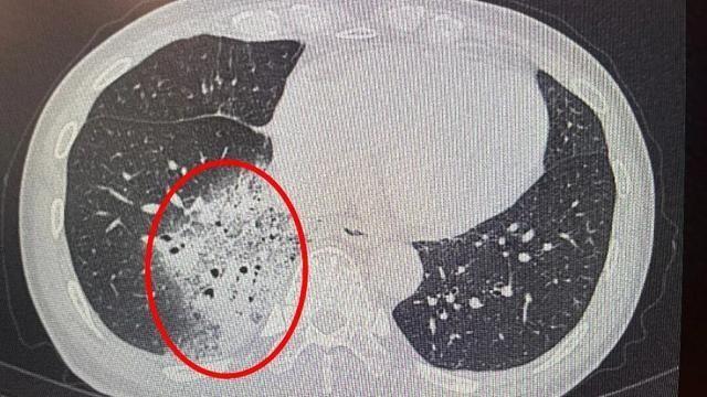 悲剧还是发生了！浙江杭州，一76岁女子晚上睡觉嫌热，开着空调睡了一整夜。结果第二