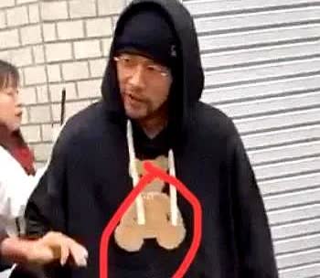 我问了骨科医生朋友，周杰伦的强直性脊柱炎到底有多严重。医生边翻病历边叹气