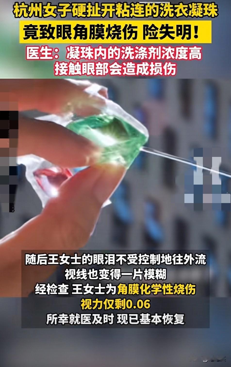 惊到失语洗衣凝珠扯破溅眼，女子视力剩0.06这东西藏着多少“隐形刀”？