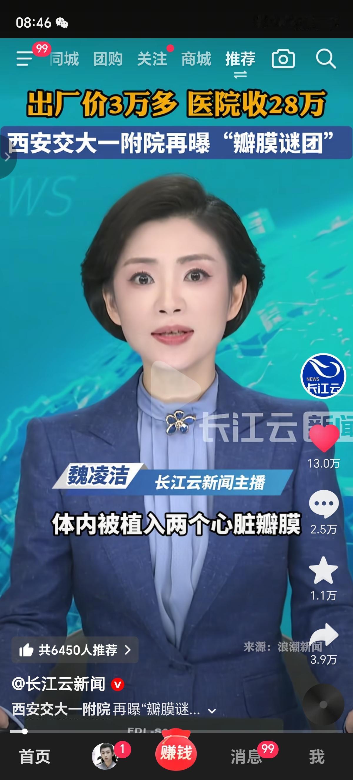 西安交大一附院，瓣膜出厂价3万多，医院收费28万，全额自费项目不通知家属，医保一