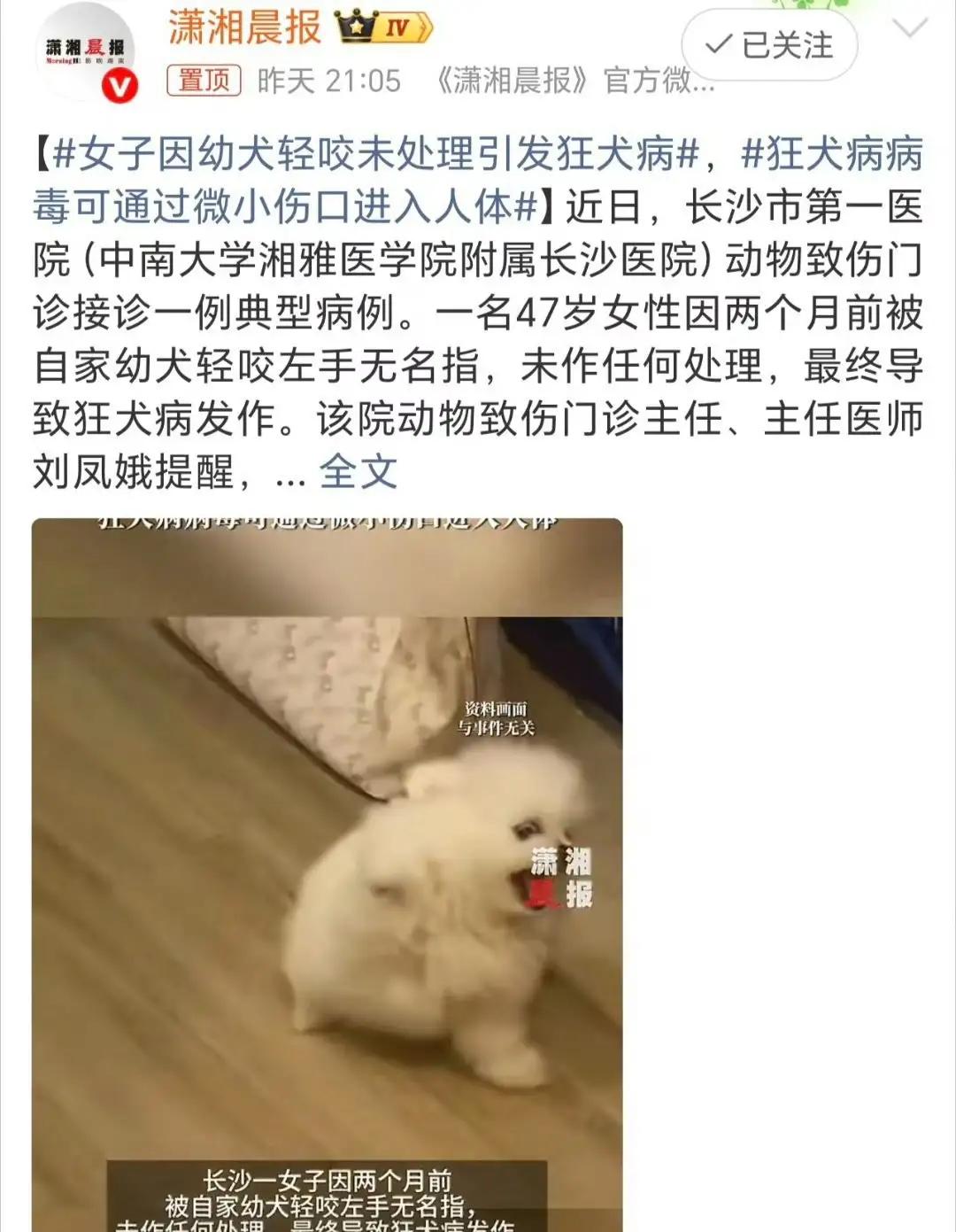震惊！长沙47岁大姐因“轻微”被咬，竟惨遭狂犬病夺命，真相令人胆寒！（素材