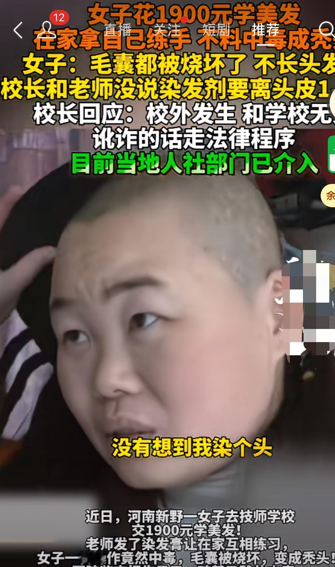 花1900学的美发，因为在家操作，染发剂烧坏毛囊，好好的小姑娘变成了秃子。学