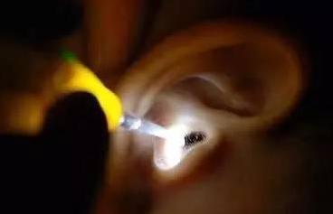 蚊虫入耳别慌张，告诉你正确做法！凌晨三点，大多数人都在梦乡，但耳鼻喉科的急诊室