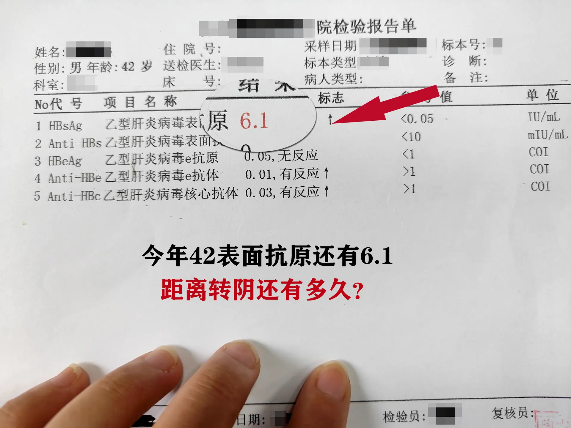 说实话单看你这个表面抗原水平，转阴希望还是挺大的，你才42岁，免疫力也...