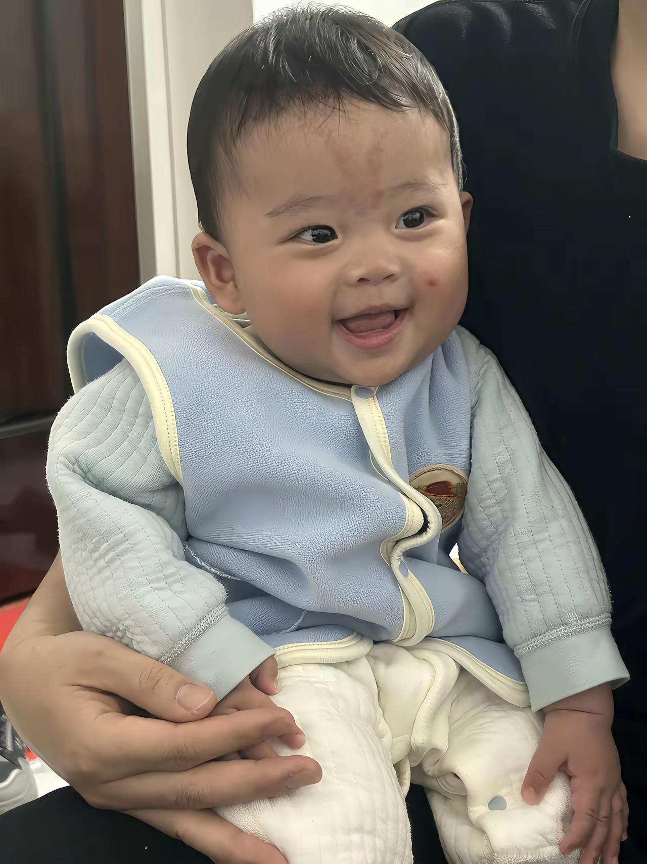 这宝宝注定这辈子与众不同！妈妈真没有必要纠结要不要给孩子医美！