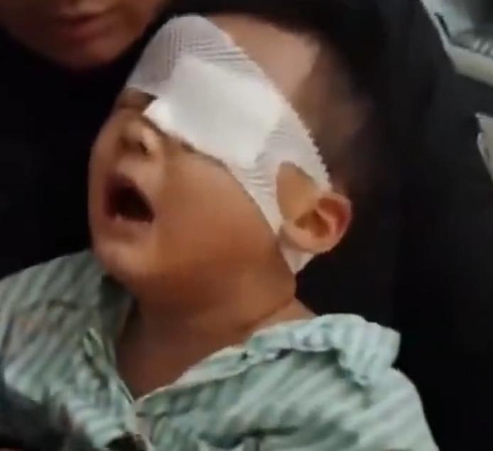 近日，江西瑞昌市的魏女士称：自己5岁的儿子在幼儿园被同学用铅笔戳到左眼，眼睛永久