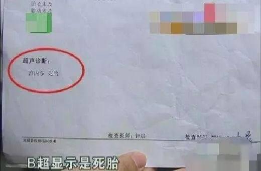 预产期来临, 分娩前的这些“信号”你知多少?
