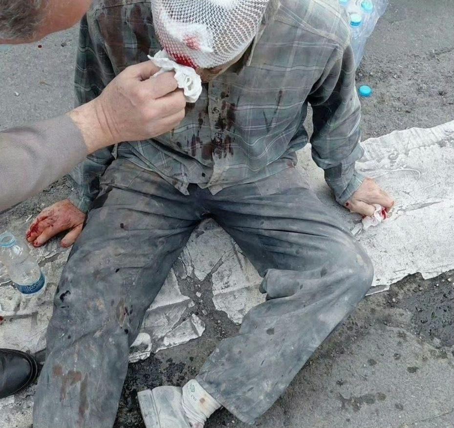 遭到袭击的伊朗受伤者