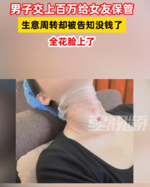 重庆，一男子将130万余元全都交给漂亮女友保管，可女友却在闺蜜的推荐下去做了医美