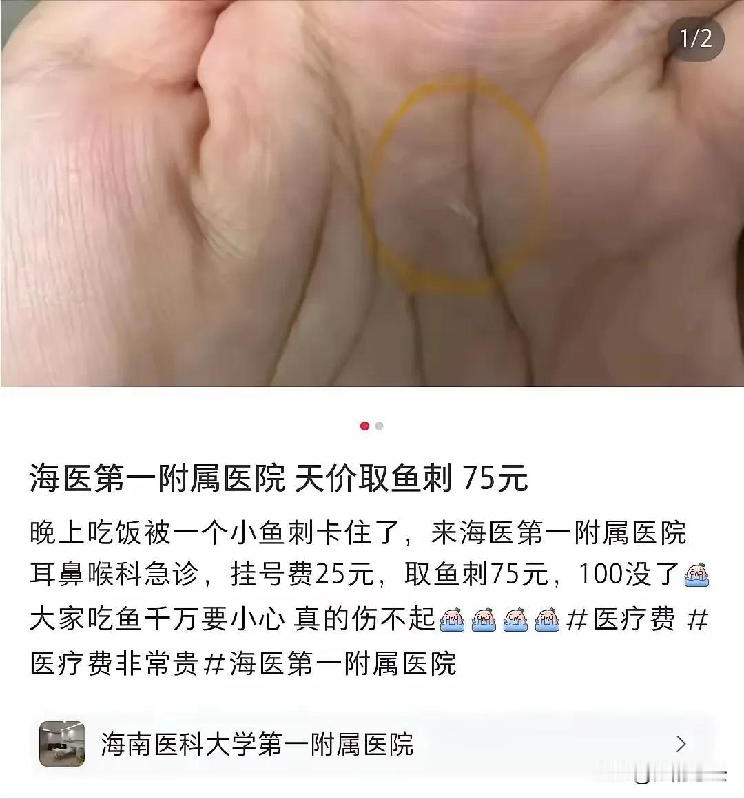 中国的医生就这么廉价吗?有网友吐槽，上医院取根鱼刺，挂号25元，取刺75元，一